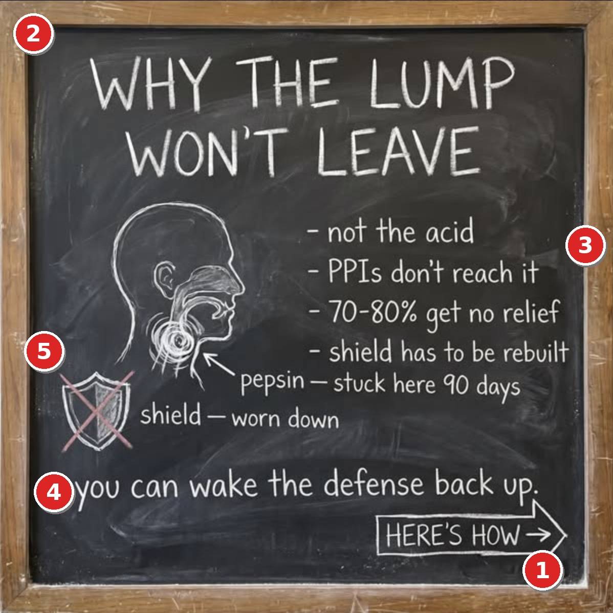 The chalkboard ad that schools you about your reflux